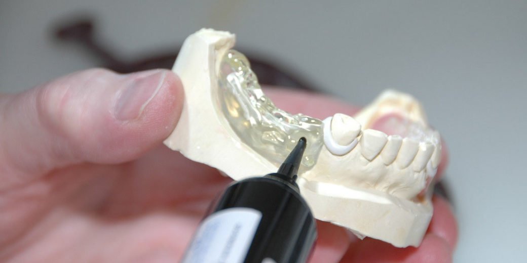 protesi fissa mobile studio dentistico melucci salerno
